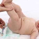 dermatitisdelpañal5