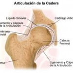 caderas3