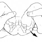 caderas5