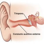 otitis externa2