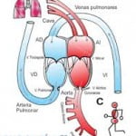 cardiopatia2