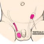 criptorquidia1