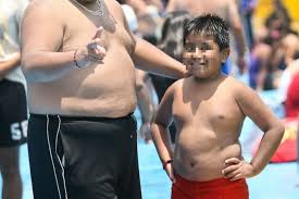 obeso1