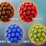 hpv1