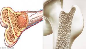 osteo1